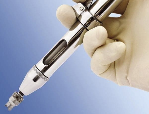 無刀輸精管結紮手術 No Scalpel Vasectomy